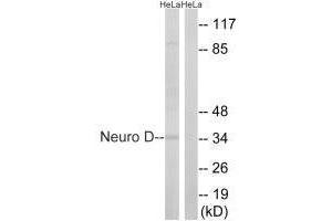 Western blot analysis of extracts from HeLa cells, using Neuro D (Ab-274) antibody. (NEUROD1 Antikörper  (Ser272))