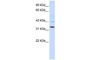 Crystallin Zeta antibody used at 1 ug/ml to detect target protein. (CRYZ Antikörper)