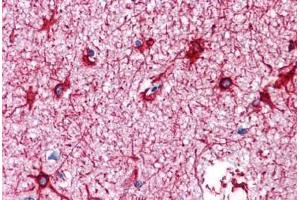 Human Brain, Cortex: Formalin-Fixed, Paraffin-Embedded (FFPE) (GFAP Antikörper)