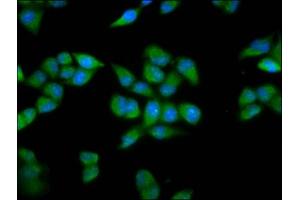 Immunofluorescence staining of Hela cells with ABIN7164105 at 1:200, counter-stained with DAPI. (PRDM11 Antikörper  (AA 63-215))