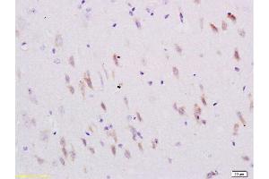 Immunohistochemistry (Paraffin-embedded Sections) (IHC (p)) image for anti-Sema Domain, Immunoglobulin Domain (Ig), Transmembrane Domain (TM) and Short Cytoplasmic Domain, (Semaphorin) 4C (SEMA4C) (AA 751-833) antibody (ABIN737991)