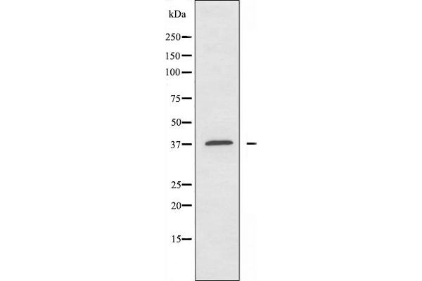 ATP6AP2 Antikörper  (Internal Region)