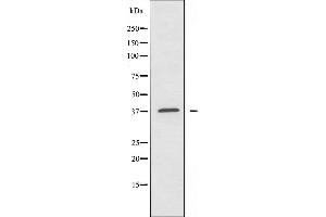Western blot analysis of extracts from COLO205 cells using Caper antibody. (ATP6AP2 Antikörper  (Internal Region))