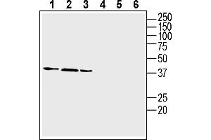 Western blot analysis of human  monocytic leukemia cell line lysate (lanes 1 and 4), human Caco-2 colon adenocarcinoma cell line lysate (lanes 2 and 5) and human  colorectal adenocarcinoma cell line lysate (lanes 3 and 6): 1-3.