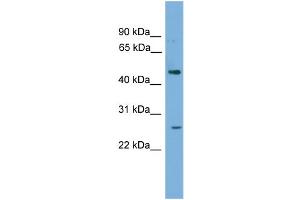 WB Suggested Anti-HLX Antibody Titration: 0. (HLX Antikörper  (Middle Region))