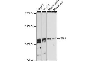 Western blot analysis of extracts of various cell lines, using IFT88 antibody (ABIN6131798, ABIN6142226, ABIN6142227 and ABIN6216899) at 1:3000 dilution. (IFT88 Antikörper  (AA 534-833))