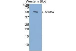 Western Blotting (WB) image for Fibrinogen beta Chain (FGB) ELISA Kit (ABIN6574262)
