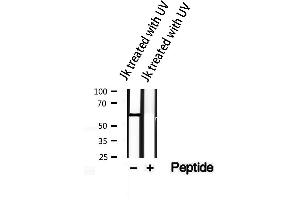 Western blot analysis of extracts from JK treated with UV, using Phospho-AKT1/2/3(Tyr315/316/312) Antibody. (AKT 1/2/3 Antikörper  (pTyr312, pTyr315, pTyr316))