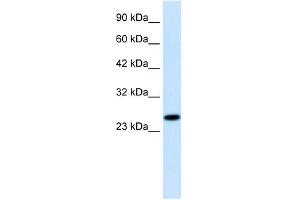 RGS13 antibody used at 1. (RGS13 Antikörper  (Middle Region))
