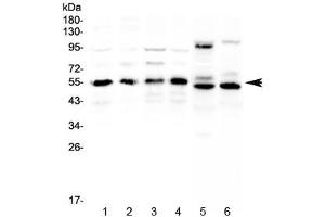 Western blot testing of human 1) HeLa, 2) COLO320, 3) A431, 4) MCF7, 5) rat heart and 6) mouse heart lysate with RXRA antibody at 0.