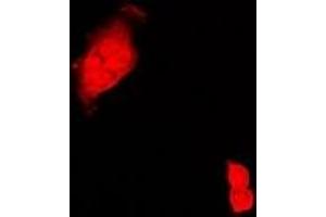 Immunofluorescent analysis of CIRBP staining in Hela cells. (CIRBP Antikörper)