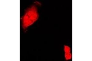 Immunofluorescent analysis of CIRBP staining in Hela cells. (CIRBP Antikörper)