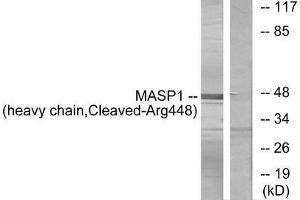 Western blot analysis of extracts from A549 cells, treated with etoposide (25uM, 24hours), using MASP1 (heavy chain, Cleaved-Arg448) antibody. (MASP1 Antikörper  (Cleaved-Arg448))