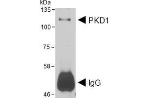 HEK293 lysate overexpressing Human DYKDDDDK-tagged PKD1 was used to immunoprecipitate PKD1 with 2ug ABIN5539576.
