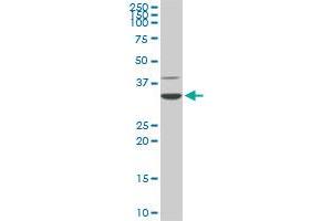 CDK4 monoclonal antibody (M07), clone 8C3. (CDK4 Antikörper  (AA 211-303))