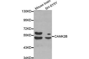 Western blot analysis of extracts of various cell lines, using CAMK2B antibody. (CAMK2B Antikörper  (AA 1-300))