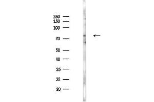 Western blot analysis of lysates from HepG2 cells(starvation,24h treatment), using Transferrin Antibody at 1/1000 dilution.