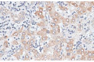 Immunohistochemistry of paraffin-embedded Human liver using GPC4 Polyclonal Antibody at dilution of 1:100 (40x lens). (GPC4 Antikörper)