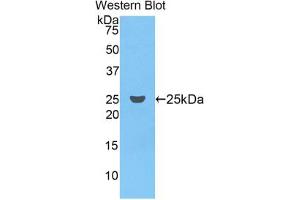 Western blot analysis of the recombinant protein. (Coagulation Factor IX Antikörper  (AA 61-263))