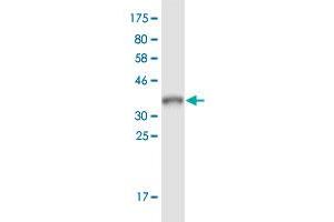 Western Blot detection against Immunogen (40. (ARL9 Antikörper  (AA 1-123))