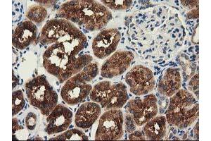 Immunohistochemical staining of paraffin-embedded Human Kidney tissue using anti-HDAC6 mouse monoclonal antibody. (HDAC6 Antikörper)