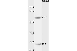 Rat liver lysates probed with Rabbit Anti-CPT1B Polyclonal Antibody (ABIN708851) at 1:200 in 4 °C. (CPT1B Antikörper  (AA 501-600))