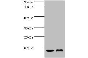 Western blot All lanes: COTL1 antibody at 5 μg/mL Lane 1: Mouse brain tissue Lane 2: Mouse kidney tissue Secondary Goat polyclonal to rabbit IgG at 1/10000 dilution Predicted band size: 16 kDa Observed band size: 16 kDa (COTL1 Antikörper  (AA 1-142))