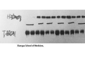 Western Blot (WB) analysis: Please contact us for more details. (BRCA1 Antikörper  (Ser183))
