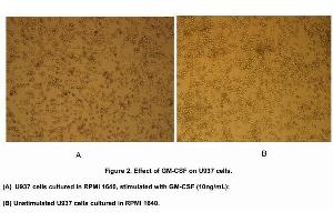 Image no. 1 for Colony Stimulating Factor 2 (Granulocyte-Macrophage) (CSF2) (AA 18-144) (Active) protein (His tag) (ABIN6239729)