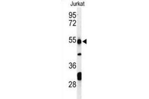 Western Blotting (WB) image for anti-Prune Exopolyphosphatase (PRUNE) antibody (ABIN3004302) (PRUNE Antikörper)