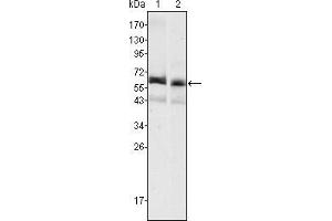 Western blot analysis using AFP mouse mAb against HepG2 (1) and SMMC-7721 (2) cell lysate. (alpha Fetoprotein Antikörper)