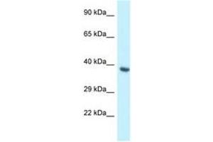 Image no. 1 for anti-BCL2-Like 12 (Proline Rich) (BCL2L12) (AA 165-214) antibody (ABIN6747456)