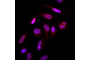 Immunofluorescence (IF) image for anti-Small Ubiquitin Related Modifier 2 (SUMO2) (AA 1-93), (N-Term) antibody (ABIN492386) (SUMO2 Antikörper  (N-Term))