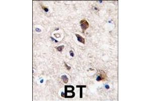 Formalin-fixed and paraffin-embedded human brain tissue reacted with PKC gamma antibody (C-term), which was peroxidase-conjugated to the secondary antibody, followed by DAB staining. (PKC gamma Antikörper  (C-Term))