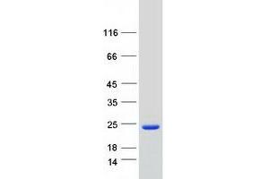 Western Blotting (WB) image for Morf4 Family Associated Protein 1-Like 1 (MRFAP1L1) (Transcript Variant 1) protein (Myc-DYKDDDDK Tag) (ABIN2726263)