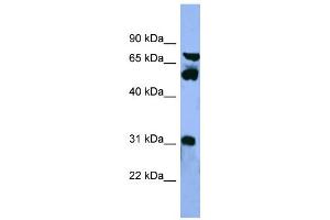 WB Suggested Anti-CYP8B1 Antibody Titration: 0. (CYP8B1 Antikörper  (Middle Region))