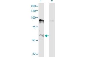 Western Blot analysis of MSL2 expression in transfected 293T cell line by MSL2 MaxPab polyclonal antibody. (MSL2 Antikörper  (AA 1-577))