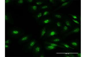 Immunofluorescence of monoclonal antibody to FBXO7 on HeLa cell.