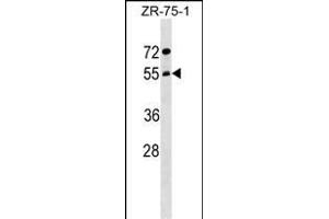 ARCN1 Antibody (Center) (ABIN1538264 and ABIN2849231) western blot analysis in ZR-75-1 cell line lysates (35 μg/lane). (ARCN1 Antikörper  (AA 296-324))