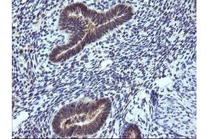 Image no. 3 for anti-Tripartite Motif Containing 38 (TRIM38) (AA 1-265) antibody (ABIN1490680)