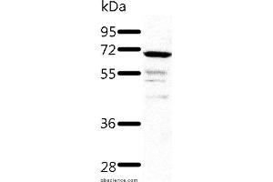 Western blot analysis of Human fetal kidney tissue, using TRAF3 Polyclonal Antibody at dilution of 1:500 (TRAF3 Antikörper)