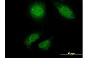 Immunofluorescence of monoclonal antibody to TTN on HeLa cell.