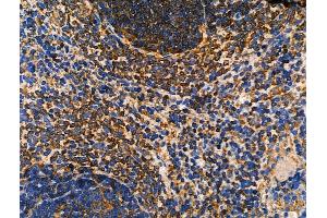 ABIN6262672 and ABIN6276585 at 1/100 staining Rat spleen tissue by IHC-P. (ISG15 Antikörper  (C-Term))