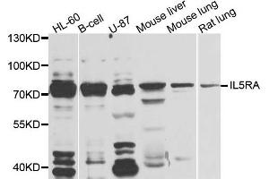 Western blot analysis of extracts of various cells, using IL5RA antibody. (IL5RA Antikörper)