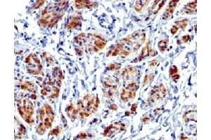 IHC testing of FFPE human uterus with recombinant Caldesmon antibody (clone CALD1/1424R). (Rekombinanter Caldesmon HMW Antikörper)