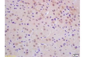 Formalin-fixed and paraffin embedded human brain labeled with Rabbit Anti dUTPase Polyclonal Antibody, Unconjugated (ABIN733478) at 1:200 followed by conjugation to the secondary antibody and DAB staining