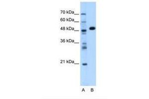 Image no. 1 for anti-Alanine Aminotransferase (ALT) (AA 115-164) antibody (ABIN320980) (ALT Antikörper  (AA 115-164))