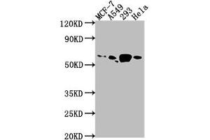 Western Blot Positive WB detected in: MCF-7 whole cell lysate, A549 whole cell lysate, 293 whole cell lysate, Hela whole cell lysate All lanes: PDE1B antibody at 1:1000 Secondary Goat polyclonal to rabbit IgG at 1/50000 dilution Predicted band size: 62, 60 kDa Observed band size: 62 kDa (PDE1B Antikörper  (AA 1-277))