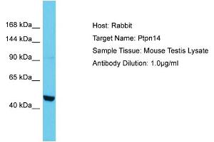 Host: Rabbit Target Name: PTPN14 Sample Tissue: Mouse Testis Antibody Dilution: 1ug/ml (PTPN14 Antikörper  (N-Term))