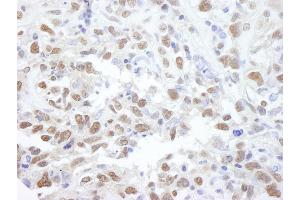 Immunohistochemistry (IHC) image for anti-Protein Phosphatase 4, Catalytic Subunit (PPP4C) (AA 1-50) antibody (ABIN7448739) (PPP4C Antikörper  (AA 1-50))